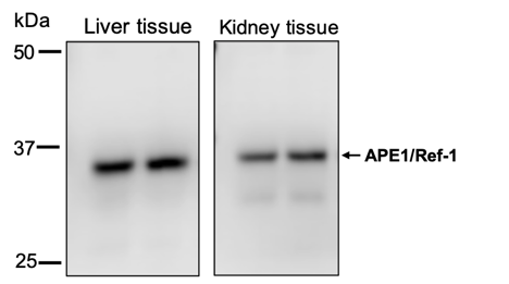 Antibody