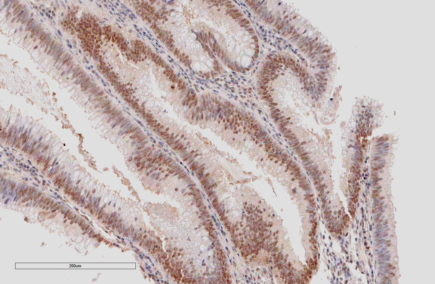 Antibody